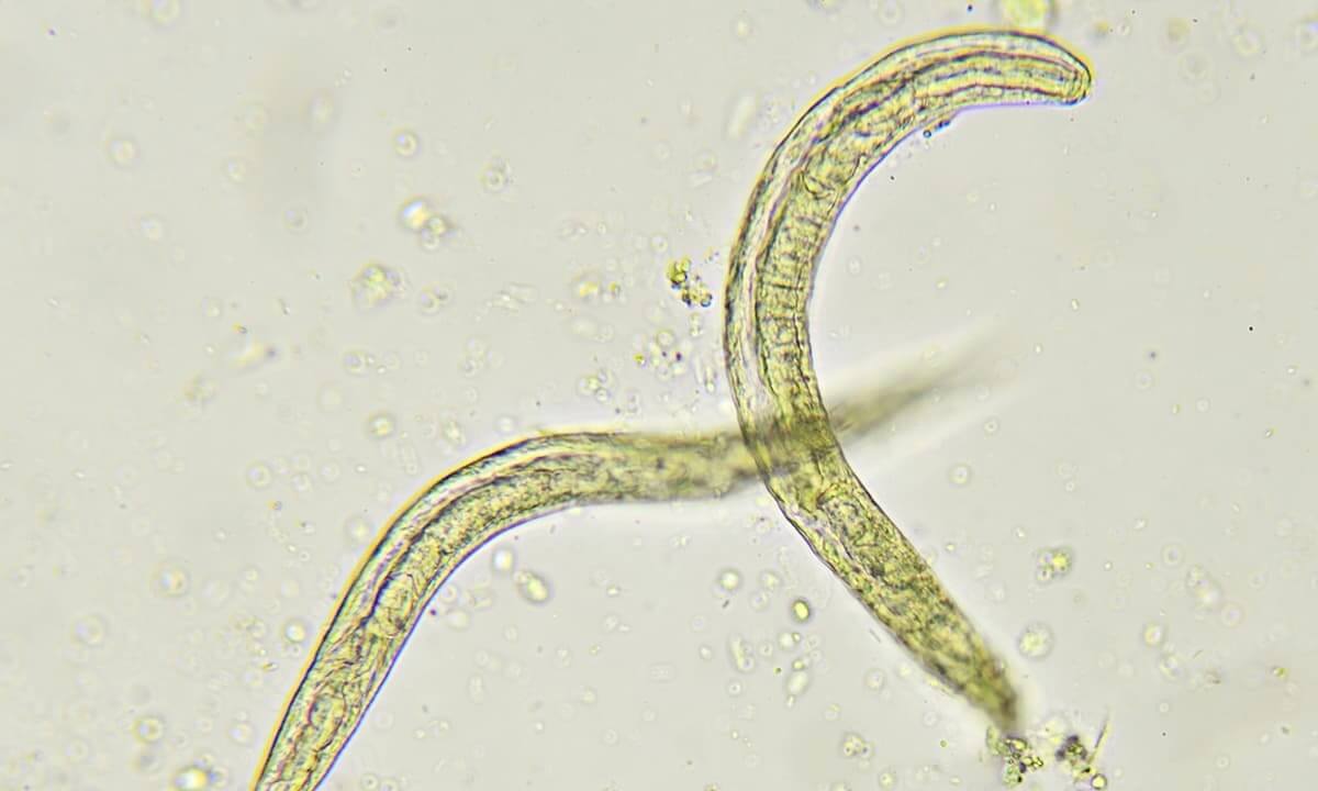 Everything to Know Tapeworms