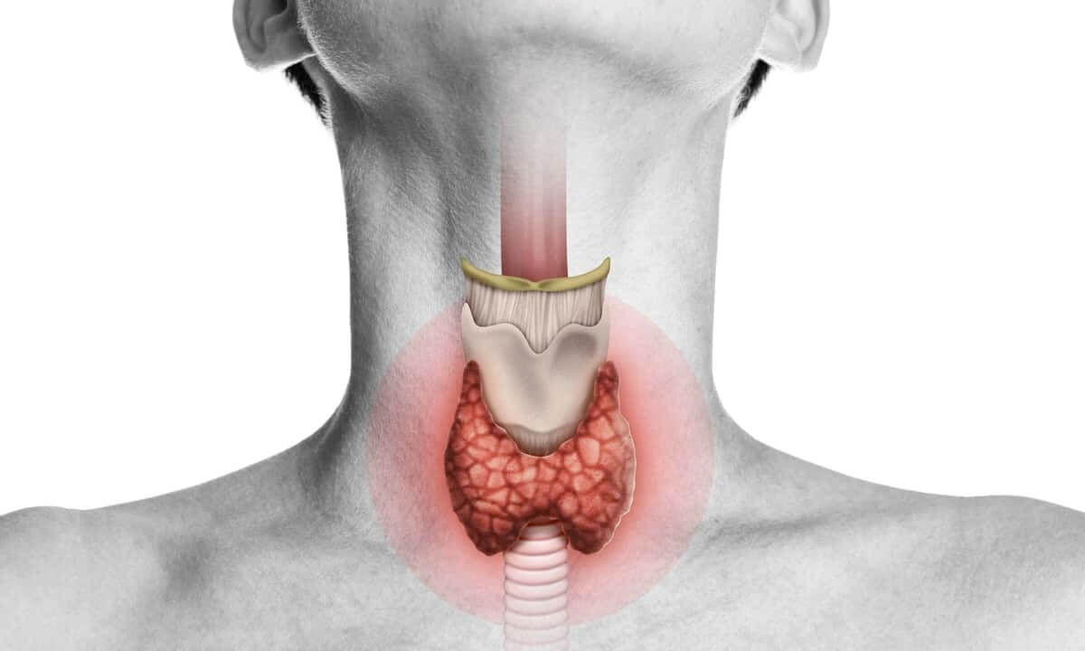 Hyperthyroid Constipation